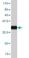 Anti-ZNF124 Antibody