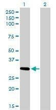 Anti-ZNF124 Antibody