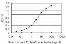Anti-ZNF124 Antibody