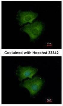 Anti-ALPPL2 Antibody