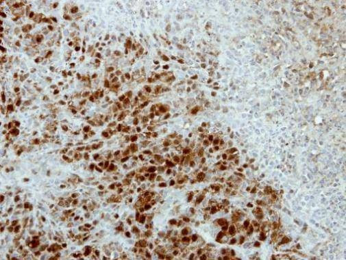 Anti-ASNA1 Antibody