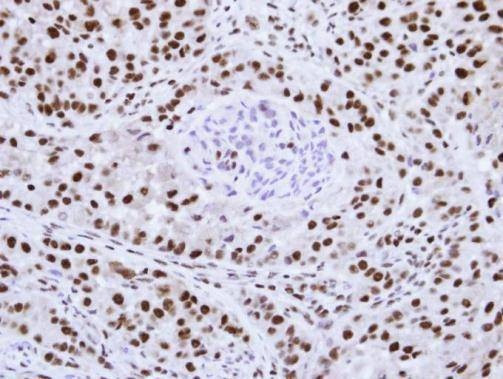 Anti-hnRNP F Antibody