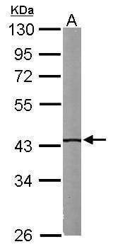 Anti-IVD Antibody