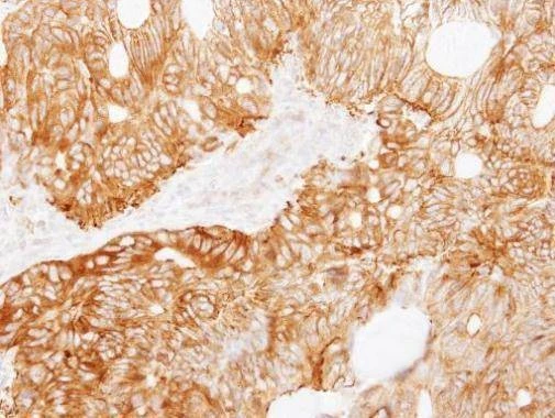 Anti-Ladinin 1 Antibody