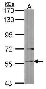 Anti-Ladinin 1 Antibody