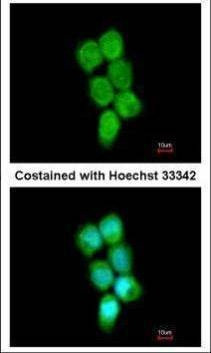 Anti-PCBP2 Antibody