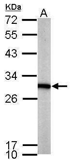 Anti-PGAM1 Antibody