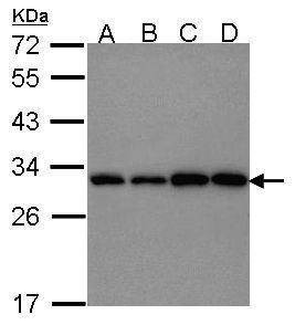 Anti-PGAM1 Antibody