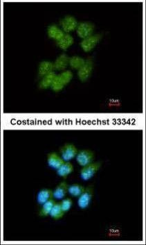 Anti-Slap Antibody