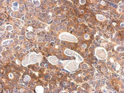 Anti-Slap Antibody
