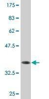 Anti-ZNF138 Antibody
