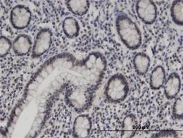 Anti-ZNF138 Antibody