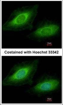 Anti-TSSC1 Antibody