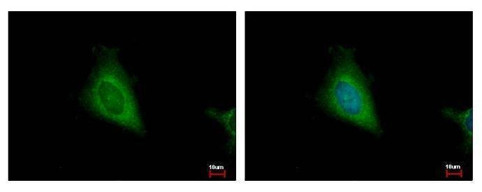 Anti-HSD17B4 Antibody