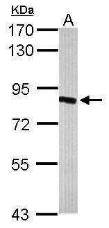 Anti-HSD17B4 Antibody