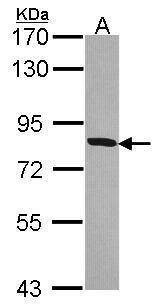 Anti-HSD17B4 Antibody