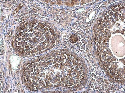 Anti-alpha Tubulin 1A Antibody