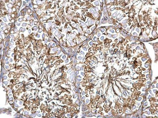 Anti-alpha Tubulin 1A Antibody