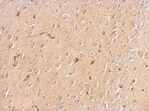 Anti-Chromogranin C Antibody