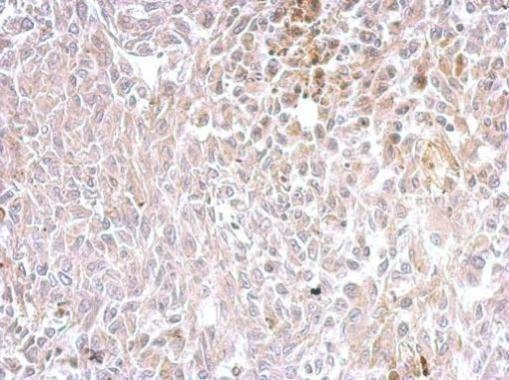 Anti-Chromogranin C Antibody