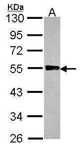 Anti-GYG2 Antibody