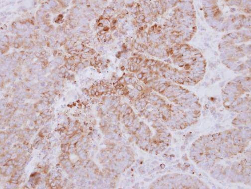 Anti-GYG2 Antibody