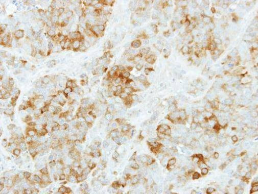 Anti-KYNU (internal) Antibody