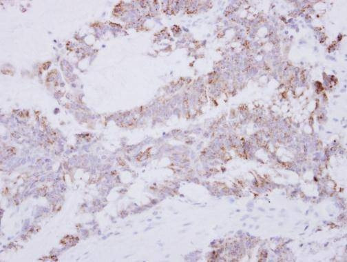 Anti-GRAP2 Antibody