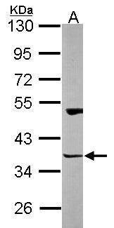 Anti-Homer3 Antibody