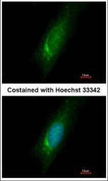 Anti-Homer3 Antibody