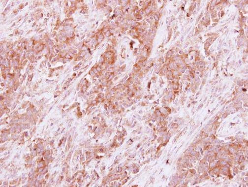 Anti-Homer3 Antibody