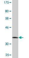 Anti-ZNF157 Antibody