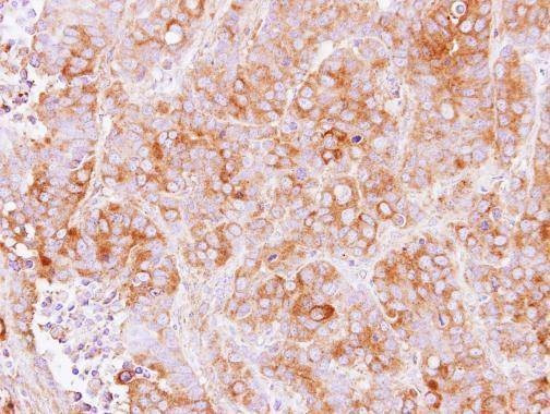 Anti-TMED2 Antibody