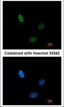 Anti-CLP1 Antibody