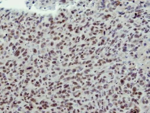 Anti-CLP1 Antibody