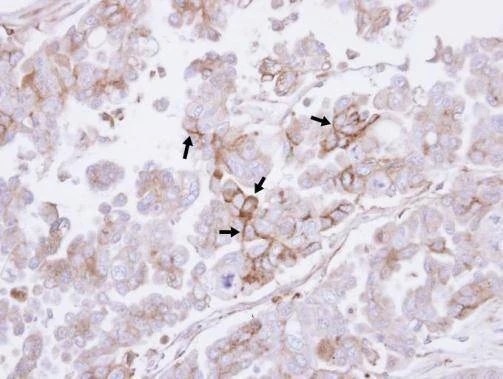 Anti-H-Ras Antibody