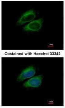 Anti-CSDE1 (internal) Antibody