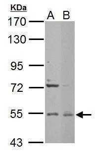 Anti-Edc3 (internal) Antibody
