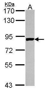 Anti-PNPase Antibody
