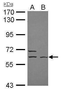Anti-ELP3 Antibody