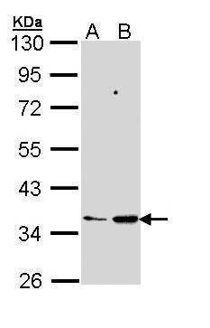 Anti-PTGES2 Antibody