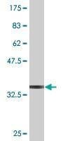 Anti-AKAP5 Antibody