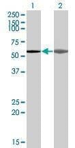 Anti-AKAP5 Antibody