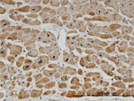 Anti-ZNF239 Antibody