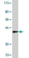 Anti-ZNF239 Antibody