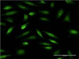Anti-ZNF274 Antibody