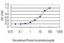 Anti-ZNF313 Antibody