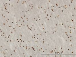 Anti-ZNF313 Antibody