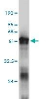 Anti-ZNF313 Antibody