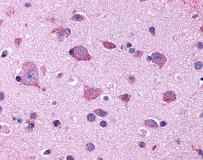 Anti-5-HT2B (Extracellular Domain) Antibody